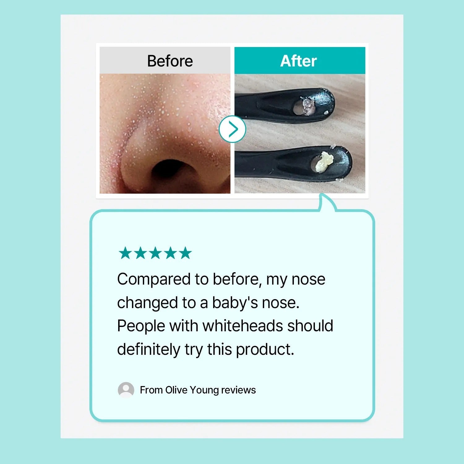 ilso Natural Mild Clear Nose Patch 10ea Special Set